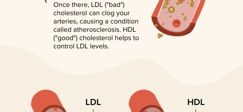 LDL cholesterol