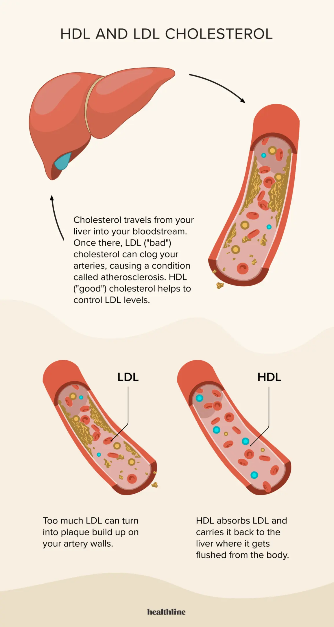 LDL cholesterol