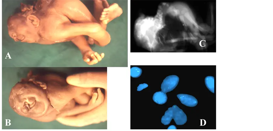 Lethal defects of the fetus. What does it mean? [WE EXPLAIN]