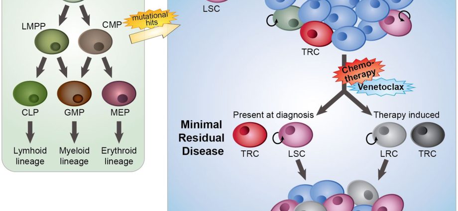 Leukemia cells are very diverse