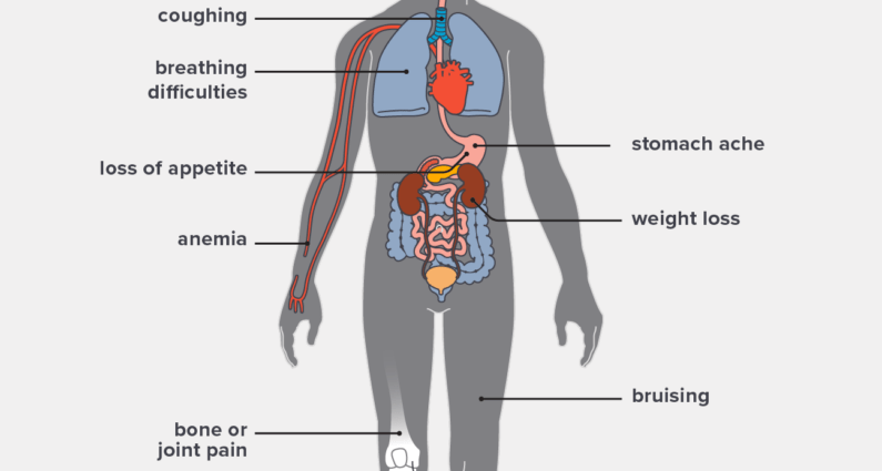 Leukemia in a child. Is a basic examination sufficient to rule out leukemia in a child?