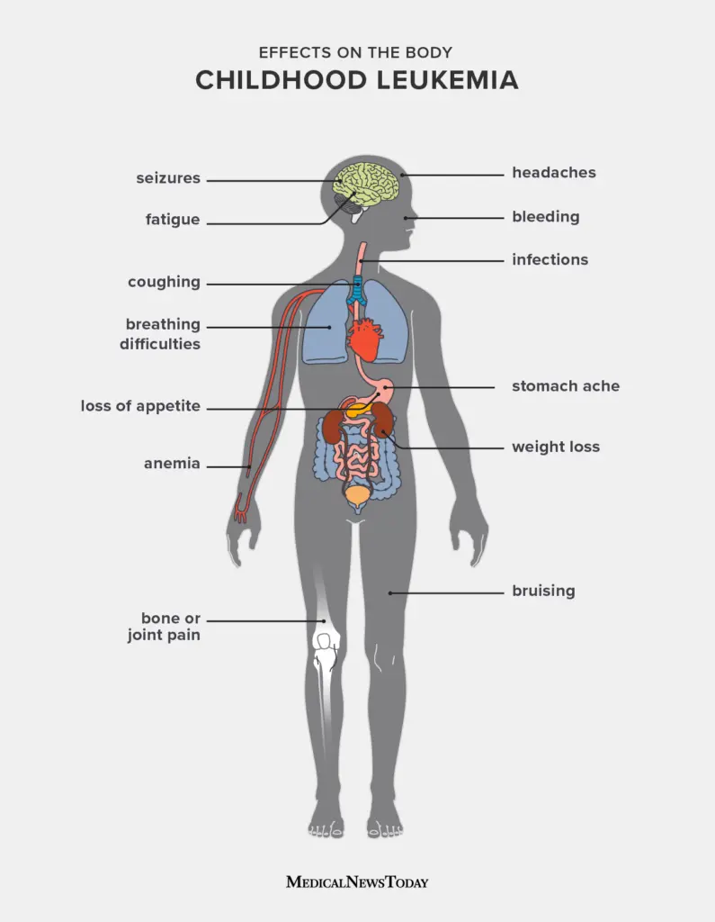 Leukemia in a child. Is a basic examination sufficient to rule out leukemia in a child?