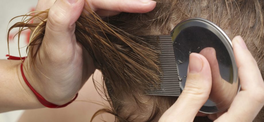 Lice in children and adults