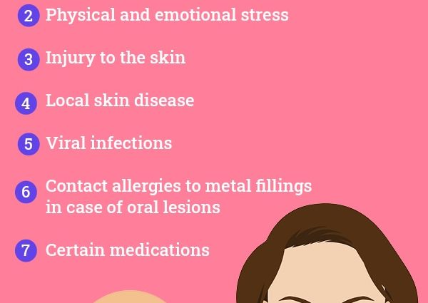 Lichen planus &#8211; causes, symptoms, diagnosis, treatment, home remedies