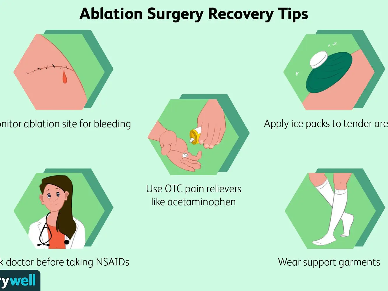 Life after ablation &#8211; what changes and how does recovery after surgery look like?