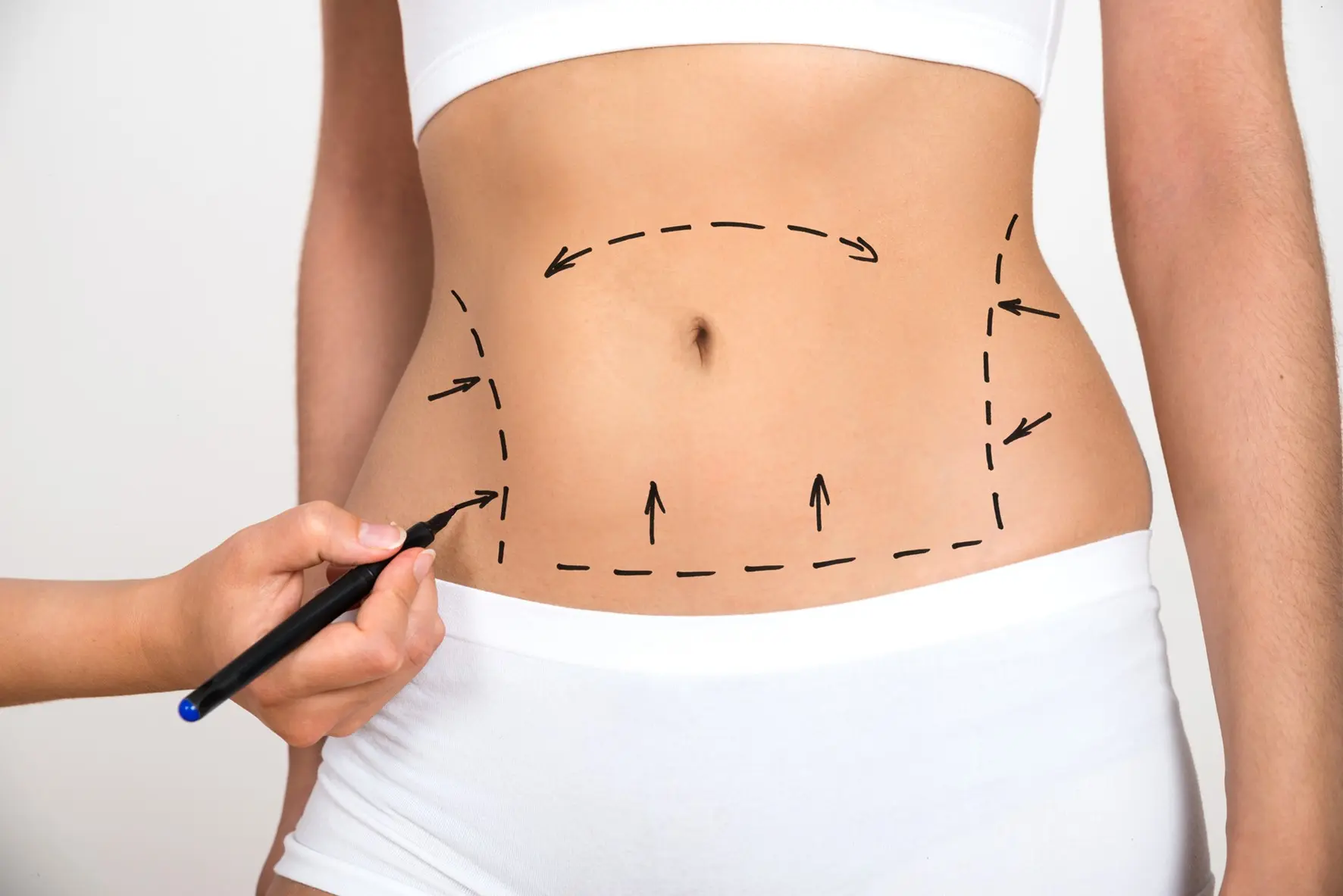 Liposuction &#8211; types, price, indications, contraindications. What is liposuction?