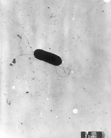 Listeriosis in cattle: symptoms, treatment and prevention
