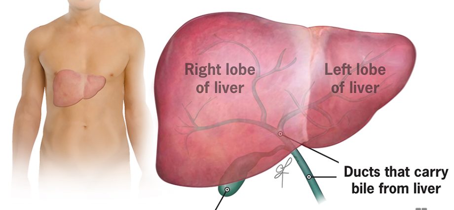 Liver cancer