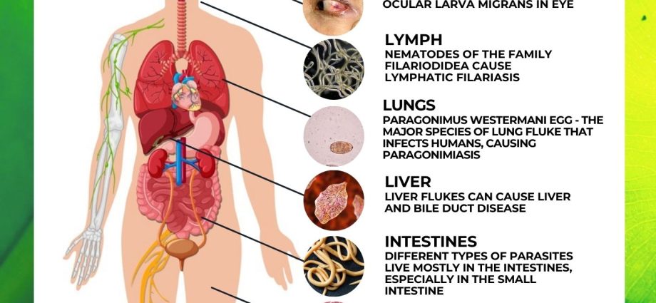 Liver mite &#8211; a parasite that can reach up to 5 cm in length. What is the diagnosis and treatment like?