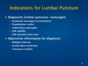 Lumbar puncture &#8211; indications and contraindications to the procedure, course, complications