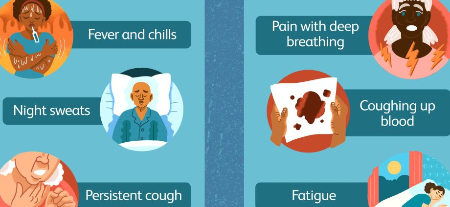 Lung abscess &#8211; causes, symptoms, diagnosis and treatment