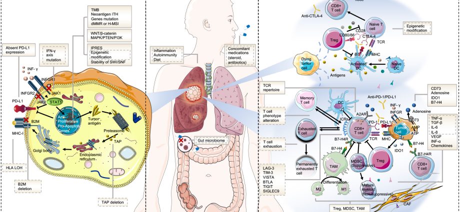 Lung cancer &#8211; the killer of Poles