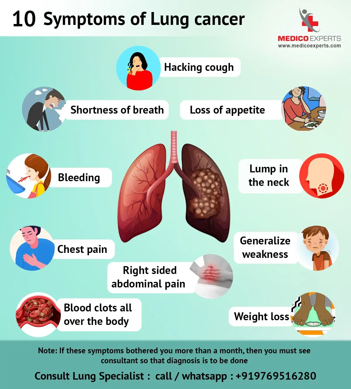 Lung cancer &#8211; what symptoms should you worry about? What symptoms should not be taken lightly?