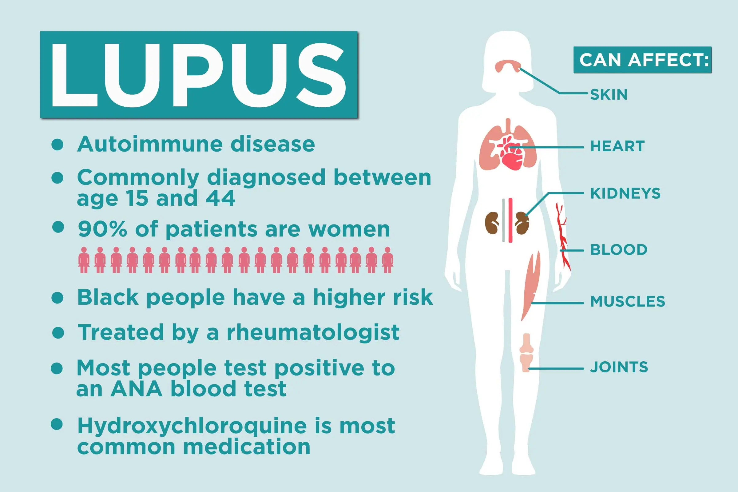 Lupus &#8211; symptoms, diagnosis, treatment