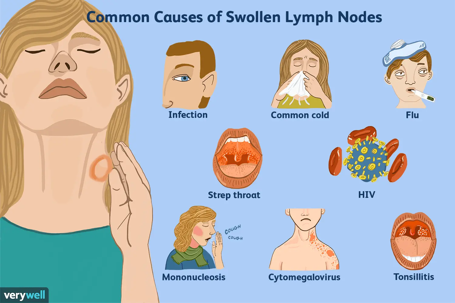 Lymph nodes &#8211; types, causes of enlargement