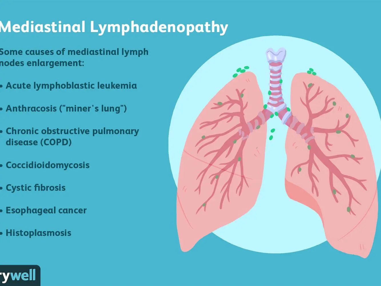 Lymphadenopathy &#8211; causes of enlarged lymph nodes. Cervical and mediastinal lymphadenopathy