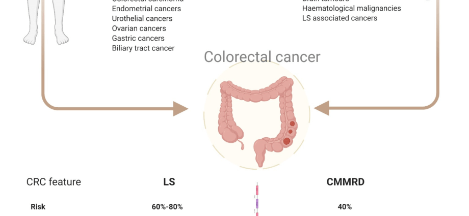 Lynch syndrome &#8211; causes, symptoms, prognosis? Rare colorectal cancer