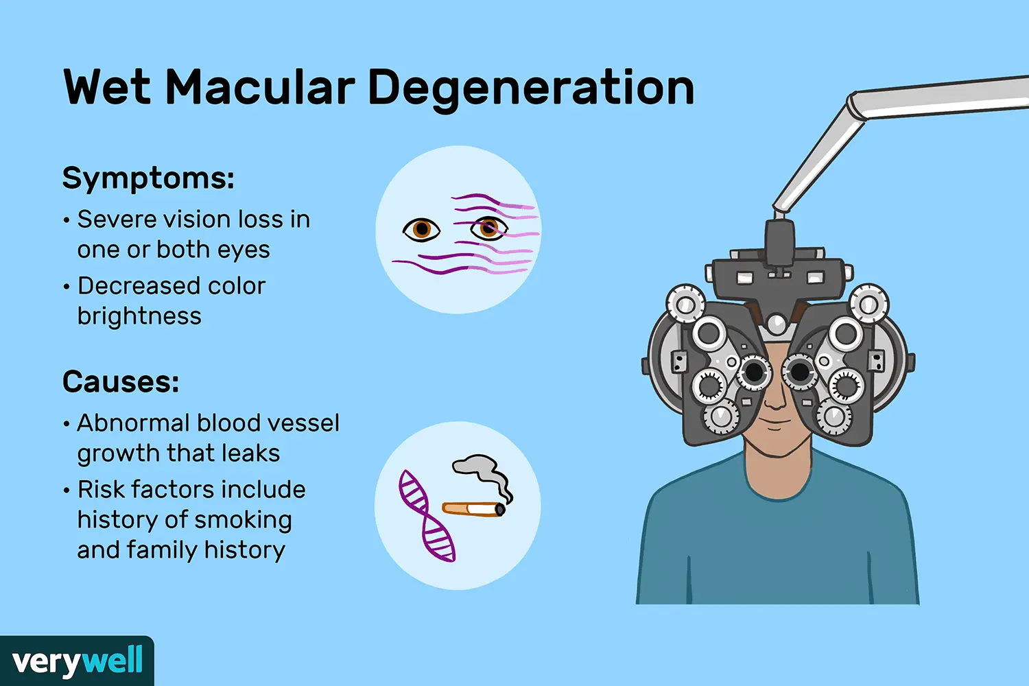 Macular Degeneration (AMD) &#8211; Symptoms, Treatment