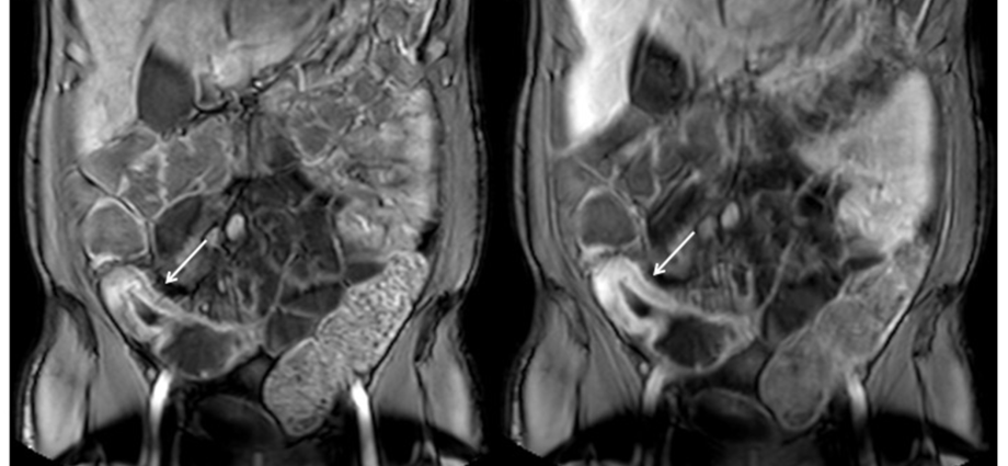 Magnetic resonance imaging of the abdominal cavity &#8211; indications, contraindications and the course of the examination