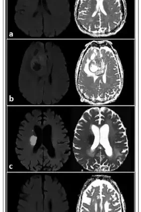 Magnetic resonance imaging of the head &#8211; operation, indications, preparation, course, price