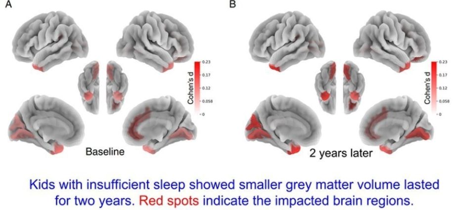 Major changes take place in the brains of children who do not get enough sleep