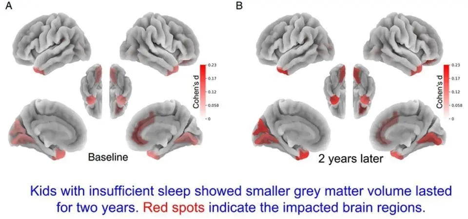 Major changes take place in the brains of children who do not get enough sleep