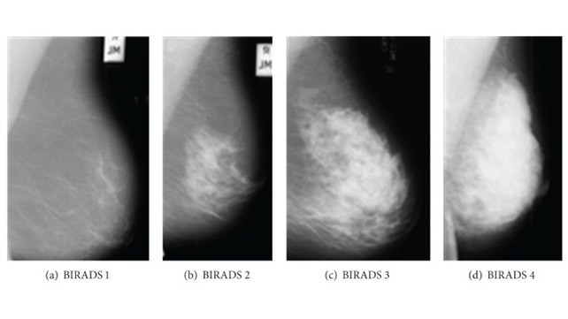 Mammography &#8211; how to interpret the results?