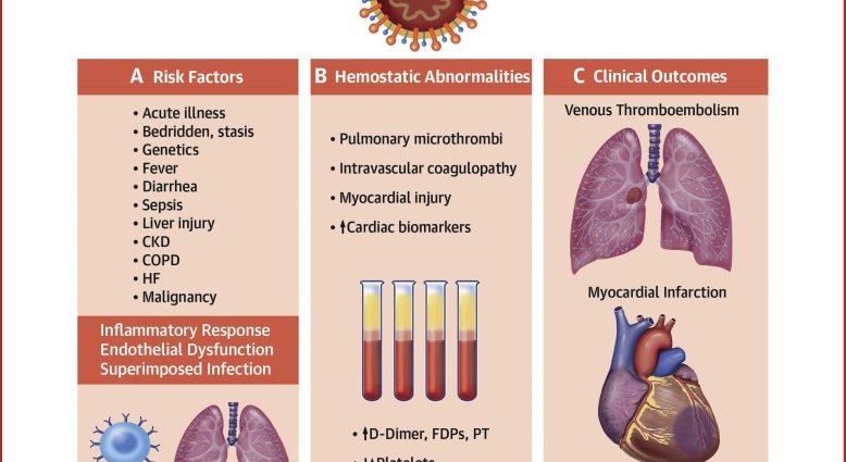 Many COVID-19 patients die of thrombosis