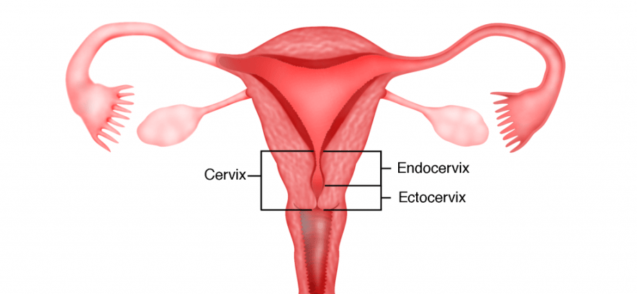 Mastka &#8211; what does it mean for the genitals, removal