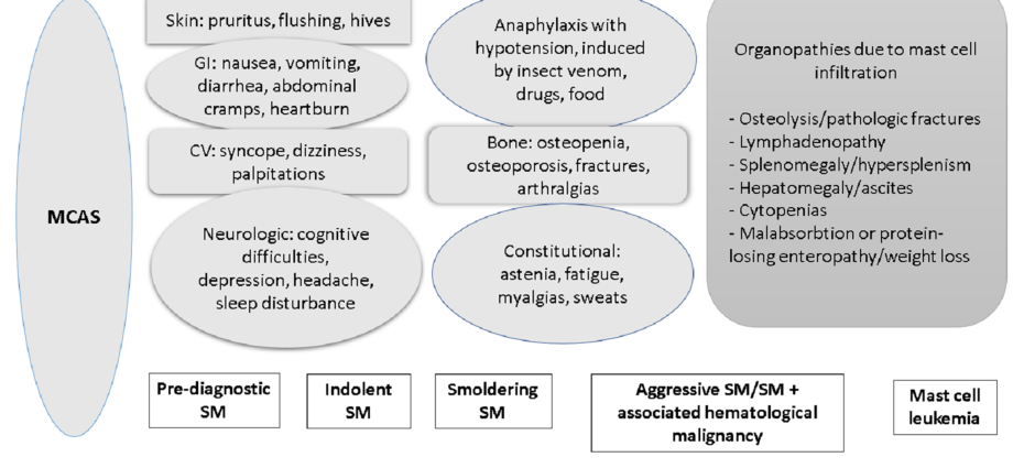 Mastocytosis &#8211; a rare cancer that is difficult to diagnose. Nonspecific symptoms of mastocytosis