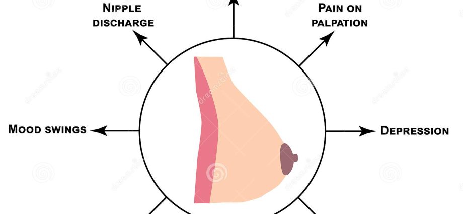 Mastopathy &#8211; what is it? Symptoms and Treatment