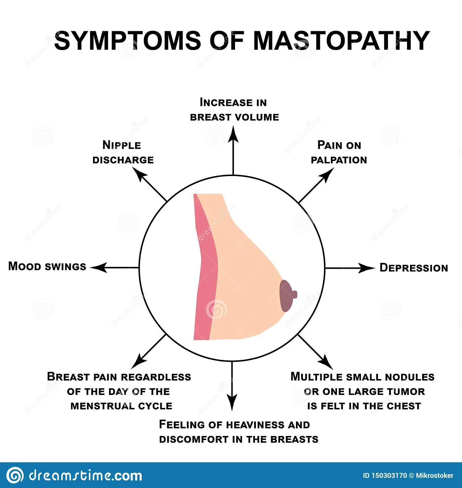 Mastopathy &#8211; what is it? Symptoms and Treatment