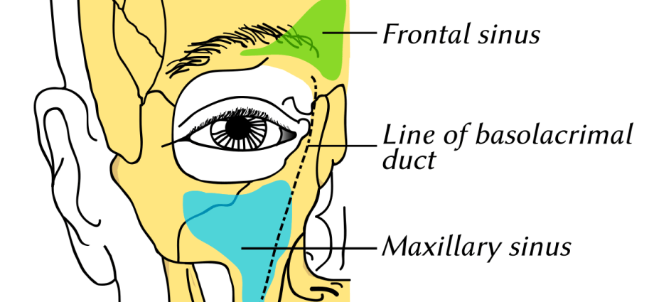 Maxillary sinuses