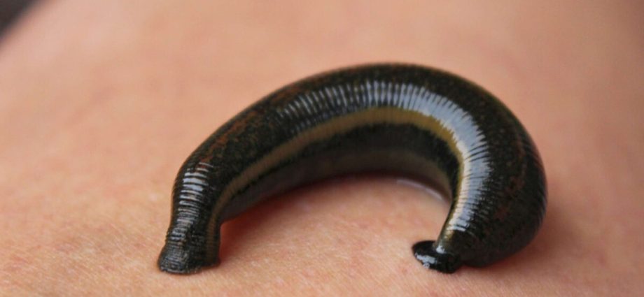 Medical leech &#8211; application, use, contraindications. What do leeches treat?