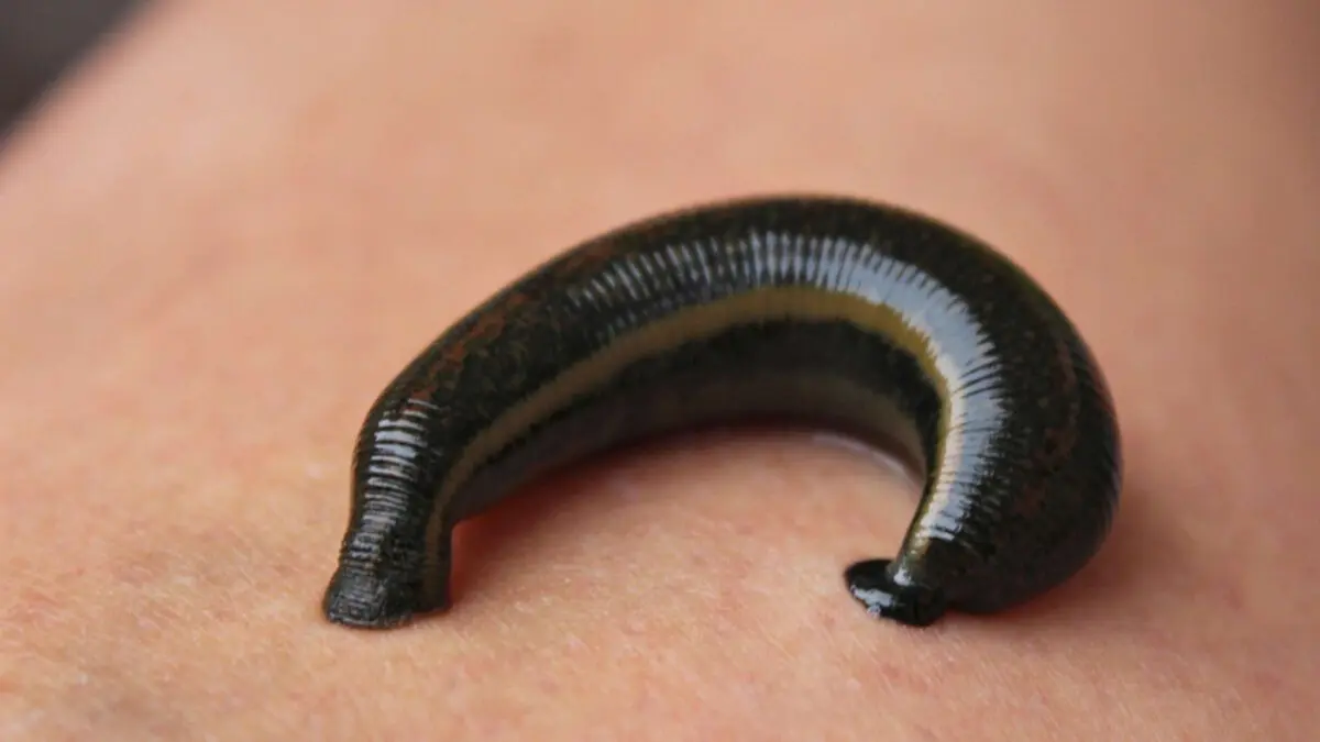 Medical leech &#8211; application, use, contraindications. What do leeches treat?