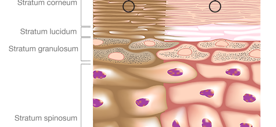 Melanin &#8211; what is it? What is its role in the body?