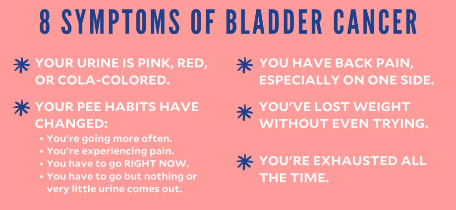 Men who smoke suffer from bladder cancer. Colored urine is the body&#8217;s alarm