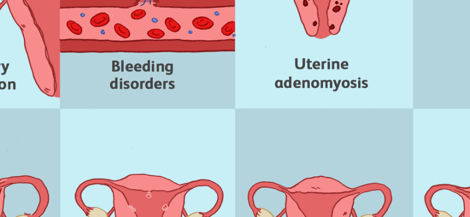 Menstrual bleeding