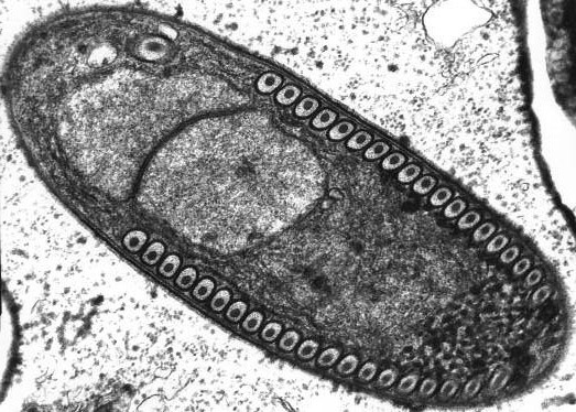 microsporydiozy