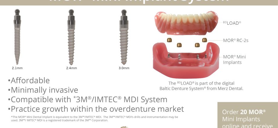 Miniimplants &#8211; characteristics, description of the procedure and prices