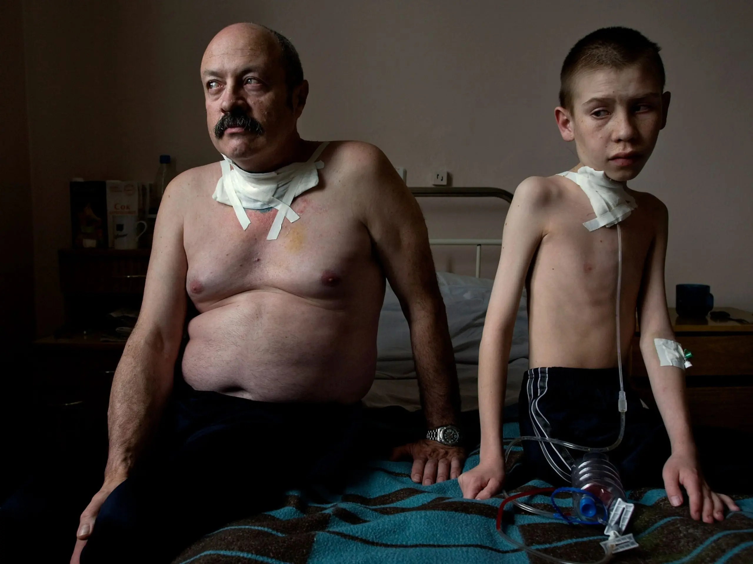 Missing limbs and twisted joints. This is how the «children of Chernobyl» live today