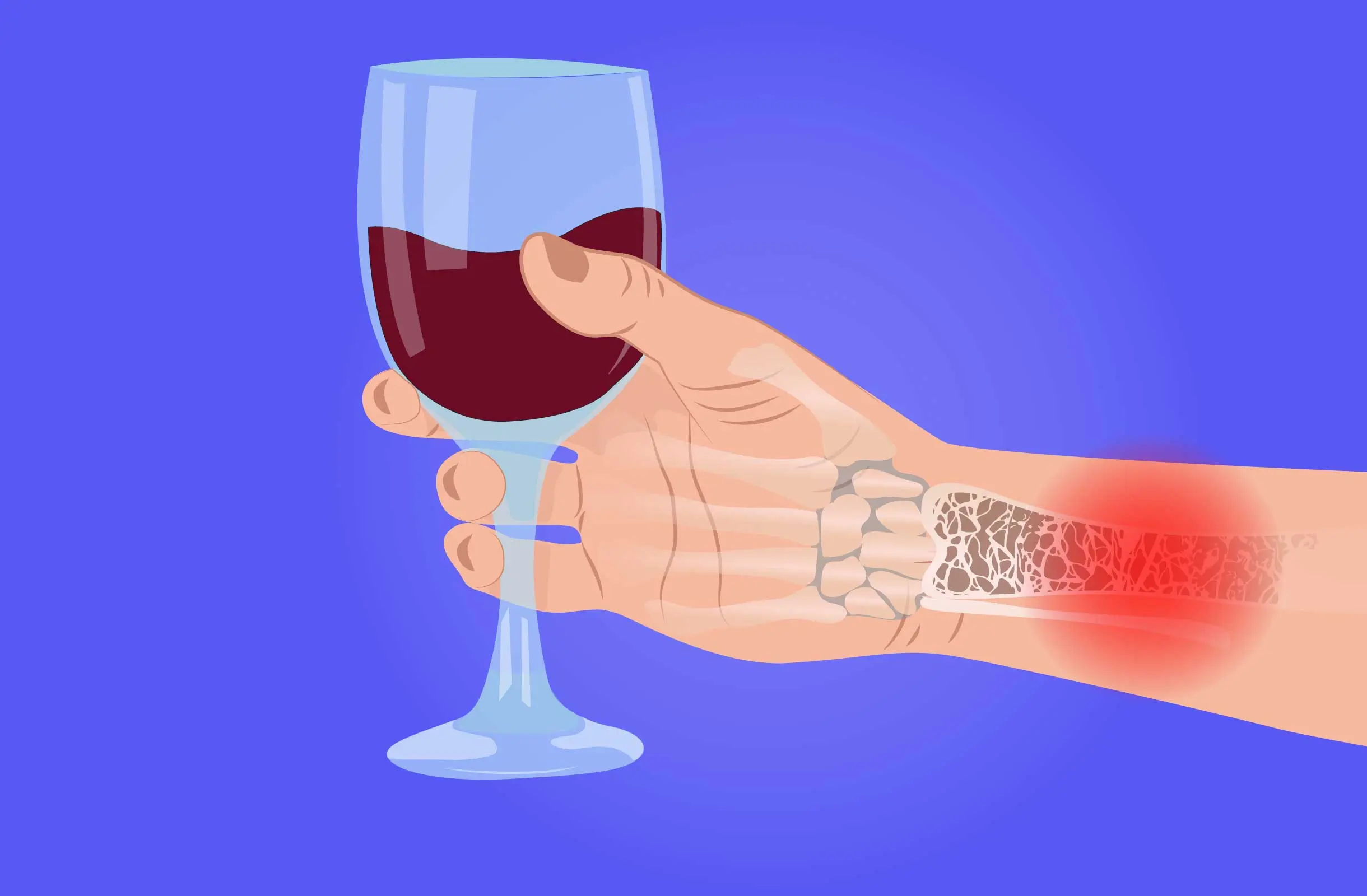 Moderate alcohol consumption can help prevent osteoporosis