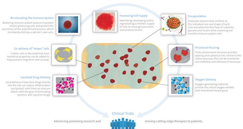 Modern methods of treating diabetes