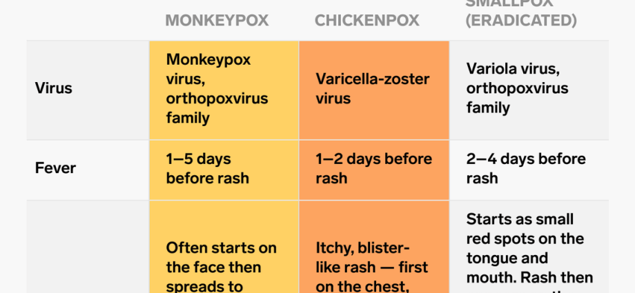 Monkey pox and chicken pox and smallpox. What are the Similarities? [WE EXPLAIN]