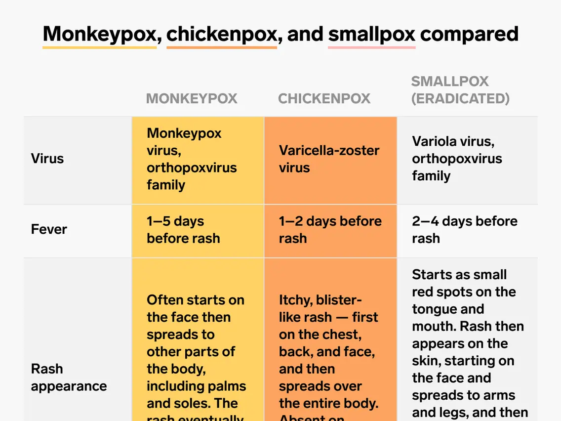 Monkey pox and chicken pox and smallpox. What are the Similarities? [WE EXPLAIN]