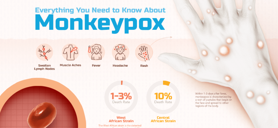 Monkey pox. Anything to worry about? Facts worth knowing [WE EXPLAIN]