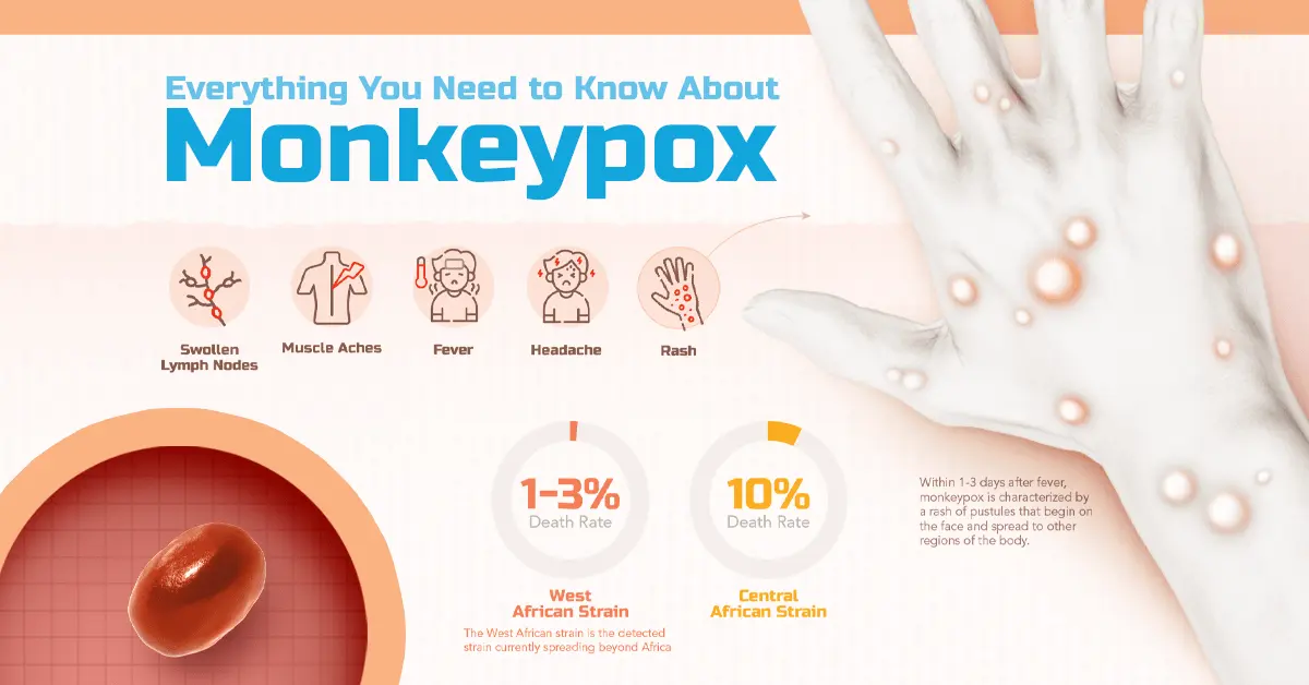 Monkey pox. Anything to worry about? Facts worth knowing [WE EXPLAIN]