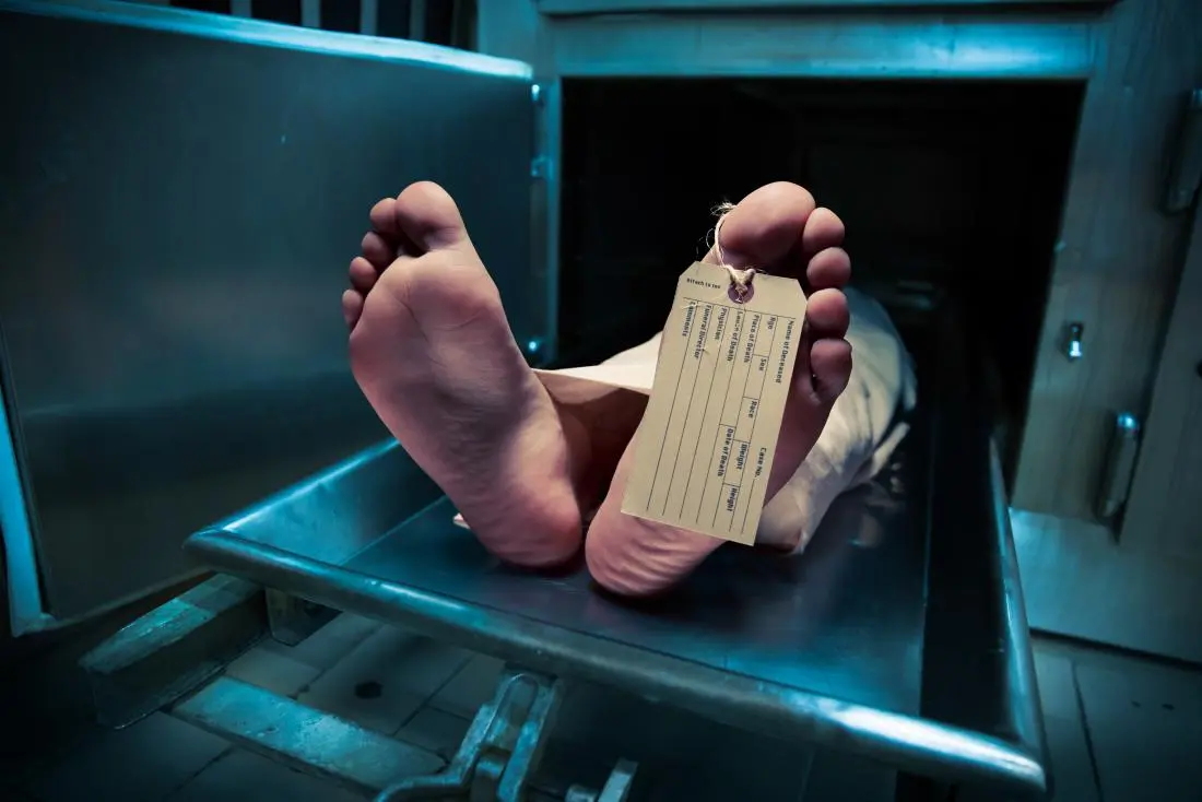 Mrs. Janina died and then came back to life in the morgue. This is Lazarus syndrome