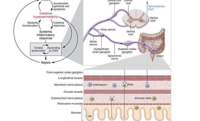 Multiorgan failure &#8211; Multiorgan dysfunction syndrome (MODS)