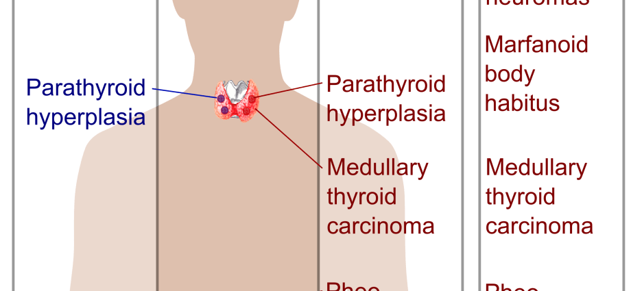 Multiple endocrine neoplasms &#8211; forms